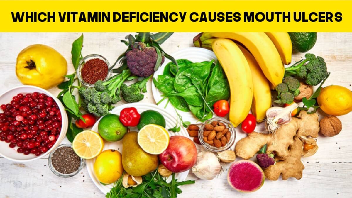 Which Vitamin Deficiency Causes Mouth Ulcers