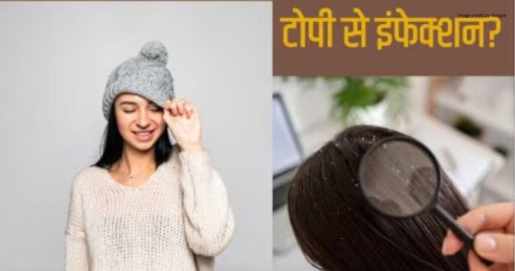 Winter Hair Care Routine Home Remedies