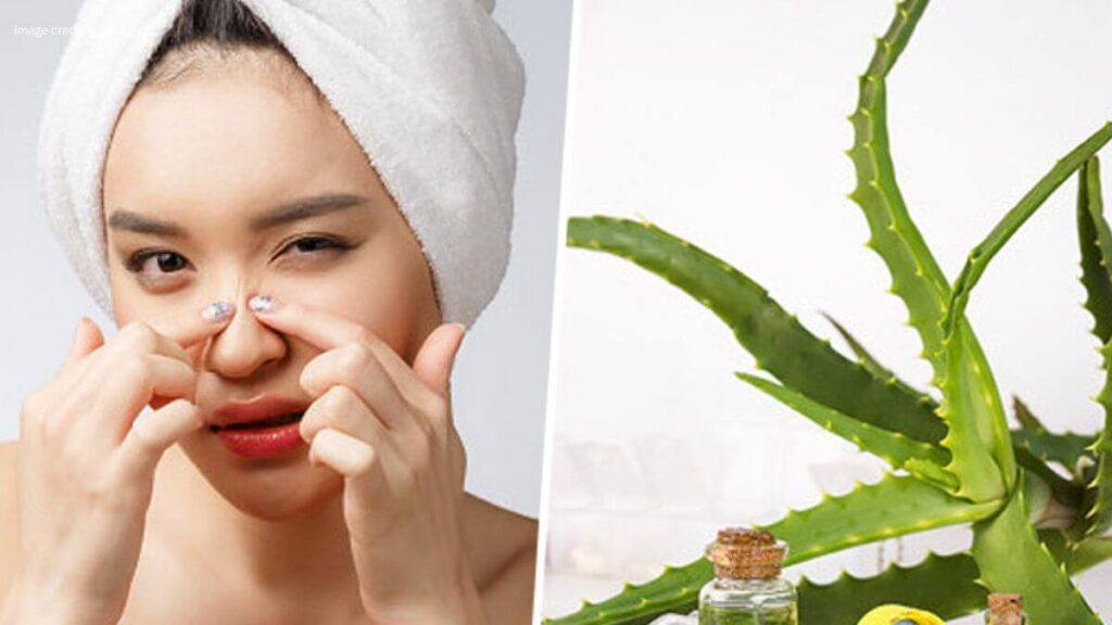 How To Remove Pimples Naturally And Permanently