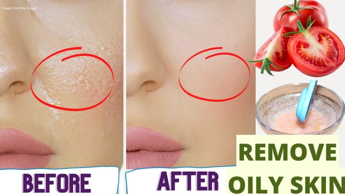 How To Remove Oily Skin Naturally At Home