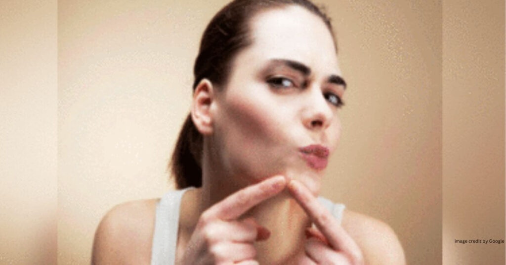 How To Remove Pimples Overnight With Toothpaste