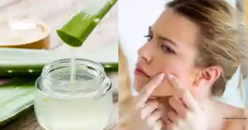 How To Remove Pimples Overnight Homemade