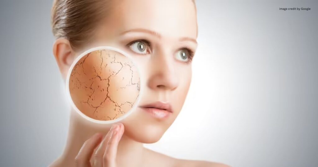 How To Treat Dry Skin On Face