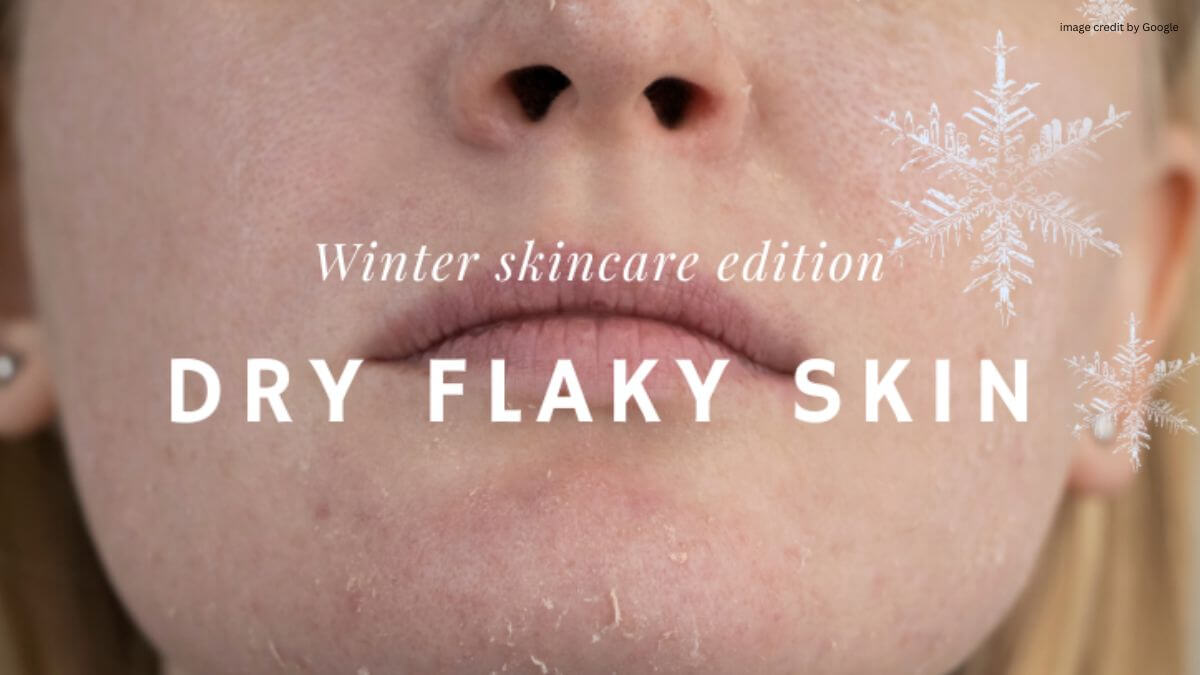 How To Treat Dry Skin On Face In Winter