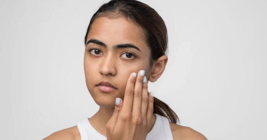 How To Treat Dry Skin On Face For Men