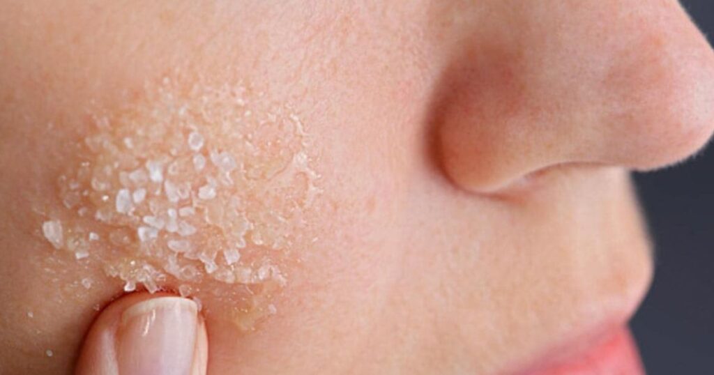 How To Treat Dry Skin On Face For Men